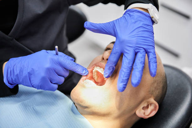 Best Broken or Chipped Tooth Repair in Roseland, OH